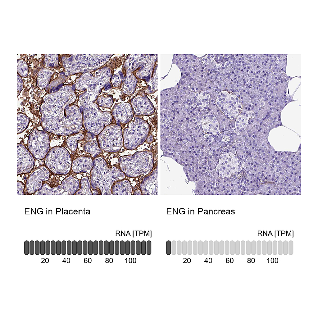 Atlas Antibodies Anti-ENG Antibody