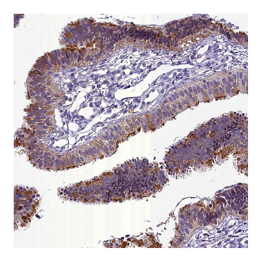 Atlas Antibodies Anti-ENKD1 Antibody