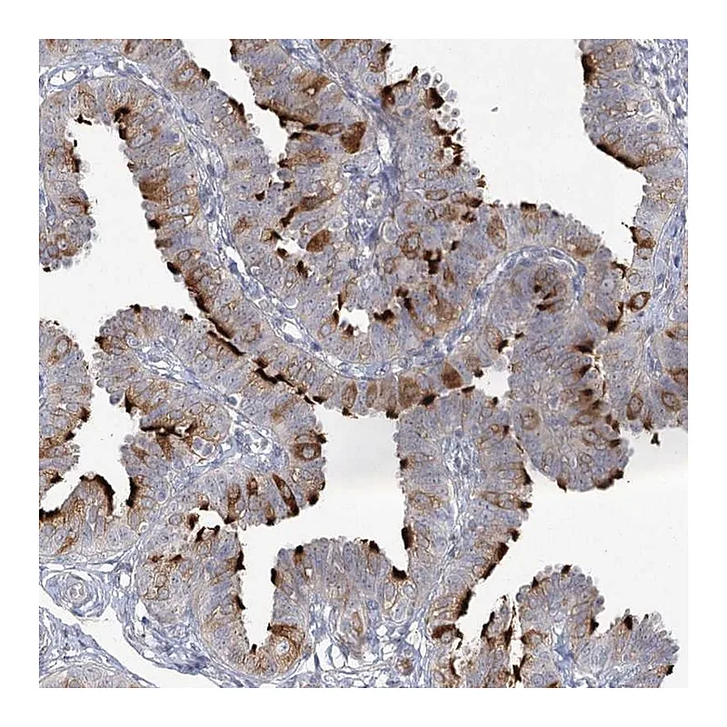 Atlas Antibodies Anti-ENO4 Antibody
