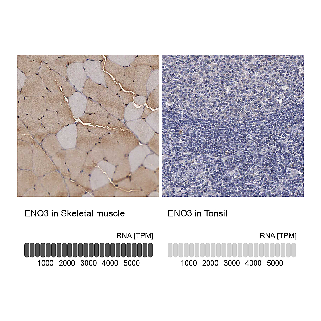 Atlas Antibodies Anti-ENO3 Antibody