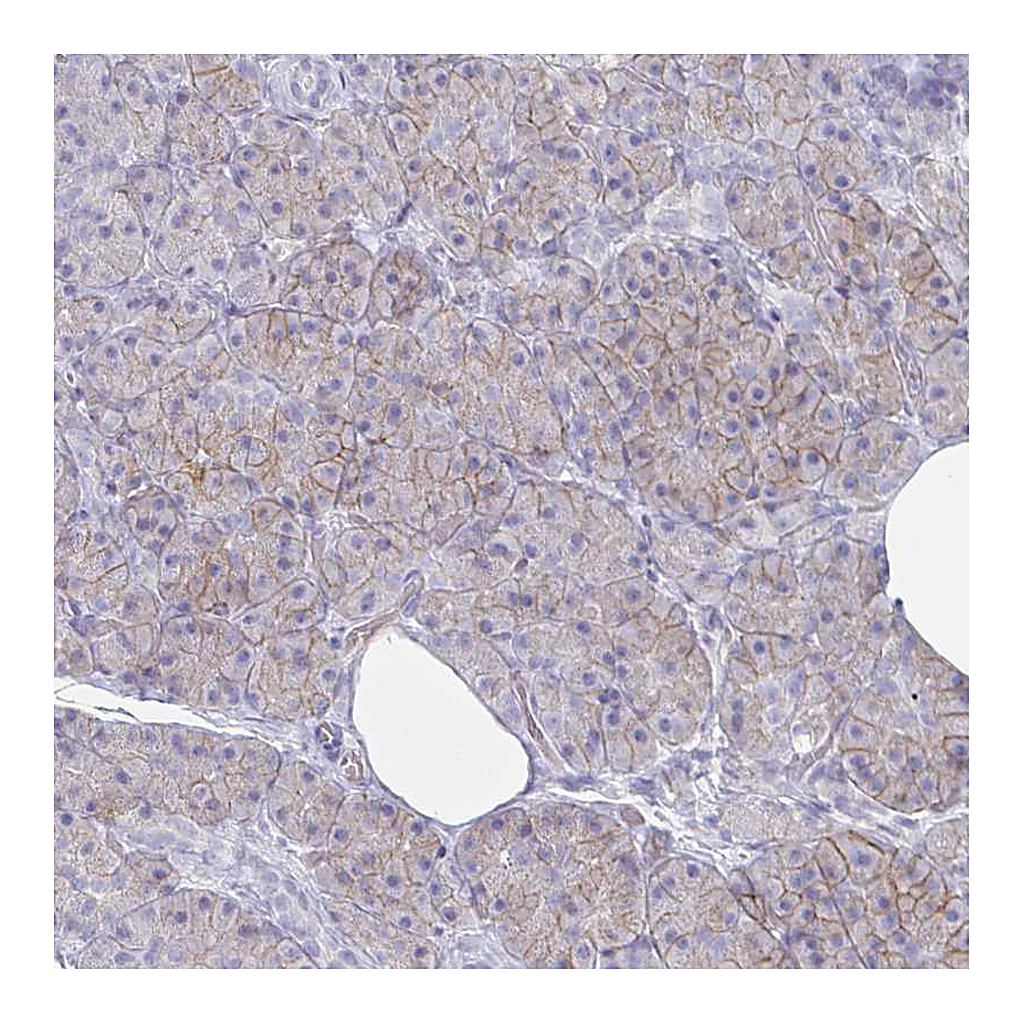 Atlas Antibodies Anti-ENPP1 Antibody