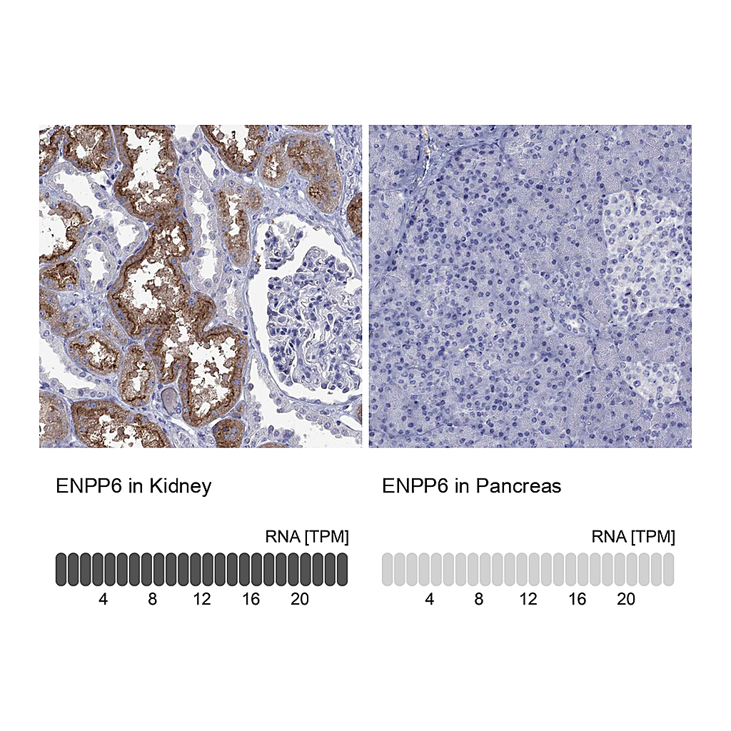Atlas Antibodies Anti-ENPP6 Antibody