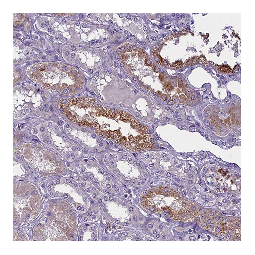 Atlas Antibodies Anti-ENPP6 Antibody