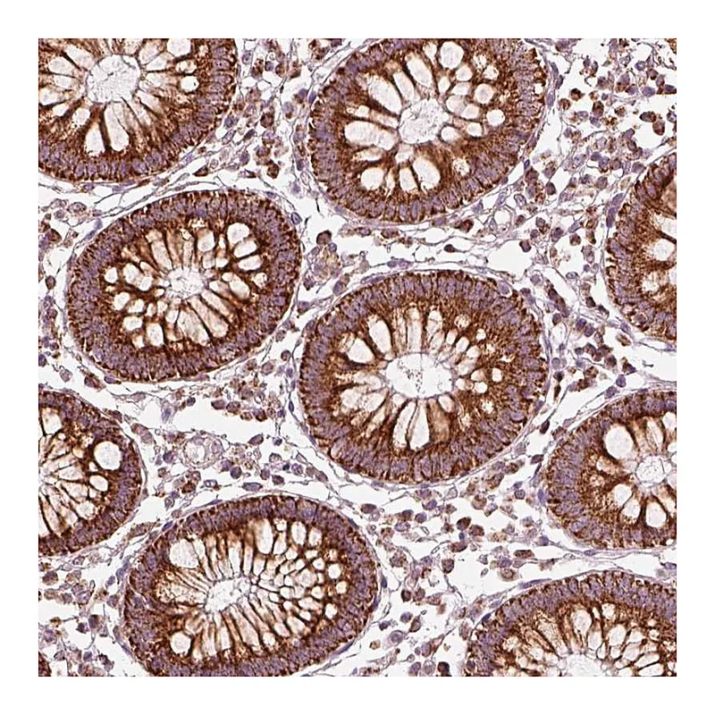 Atlas Antibodies Anti-ENTPD6 Antibody