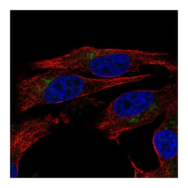 Atlas Antibodies Anti-ENTPD6 Antibody