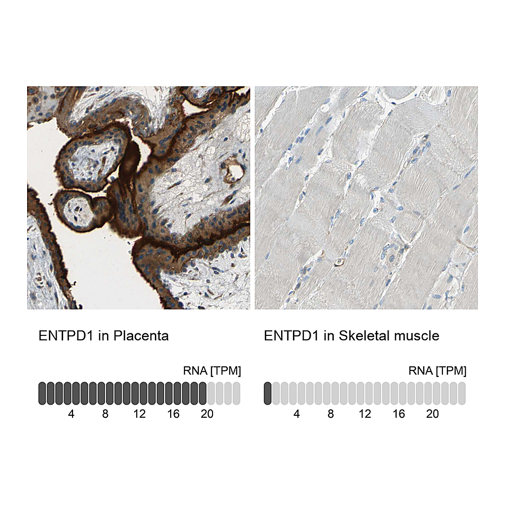 Atlas Antibodies Anti-ENTPD1 Antibody