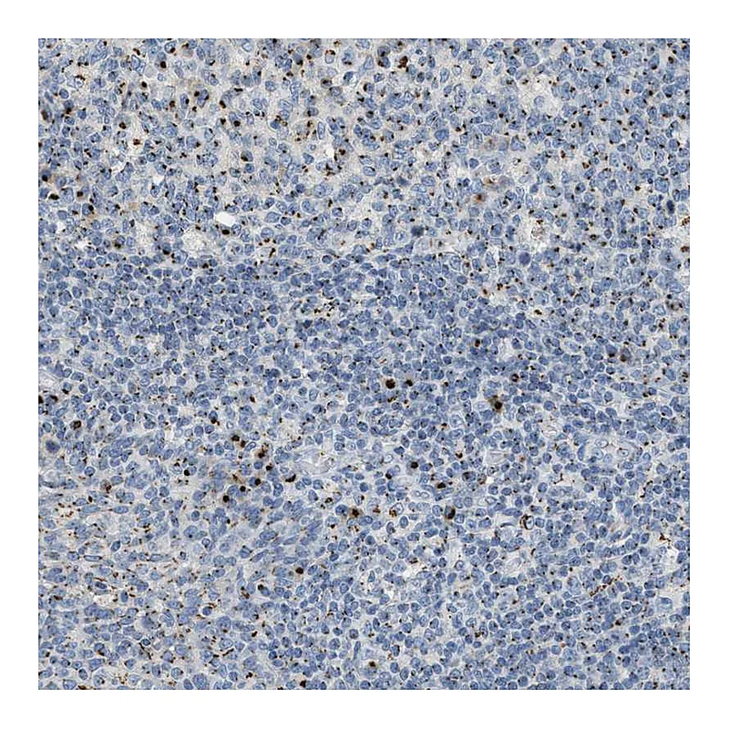 Atlas Antibodies Anti-ENTPD4 Antibody
