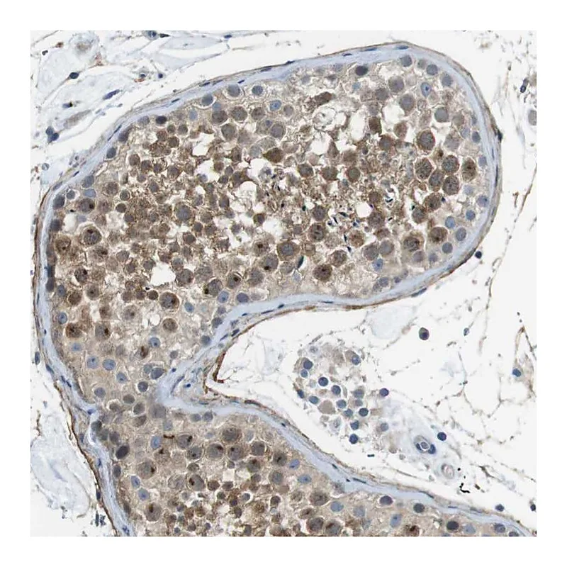 Atlas Antibodies Anti-ENTPD7 Antibody