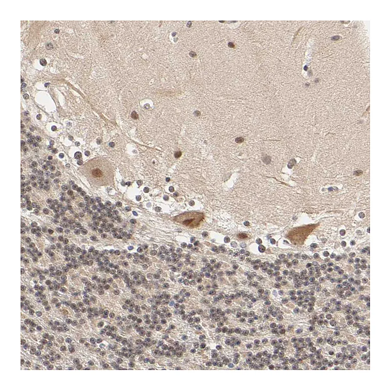 Atlas Antibodies Anti-EP300 Antibody