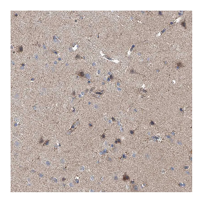 Atlas Antibodies Anti-EOMES Antibody