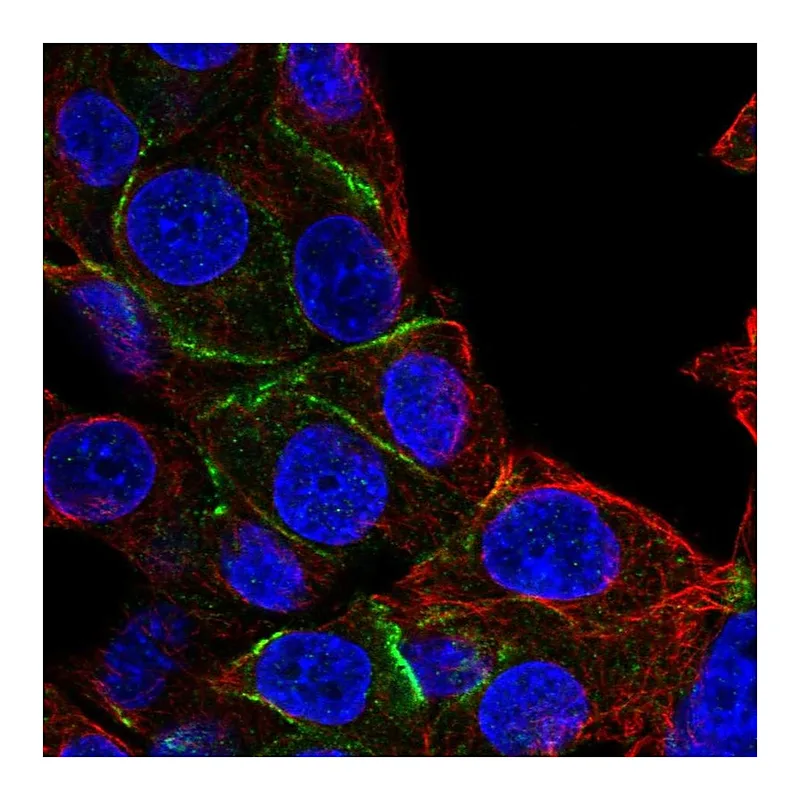 Atlas Antibodies Anti-EPB41 Antibody