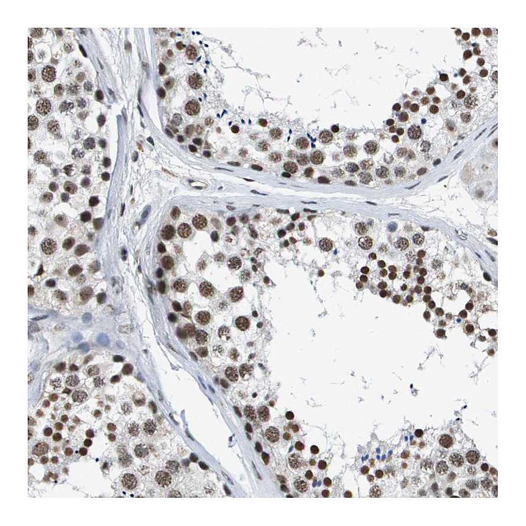 Atlas Antibodies Anti-EP400 Antibody