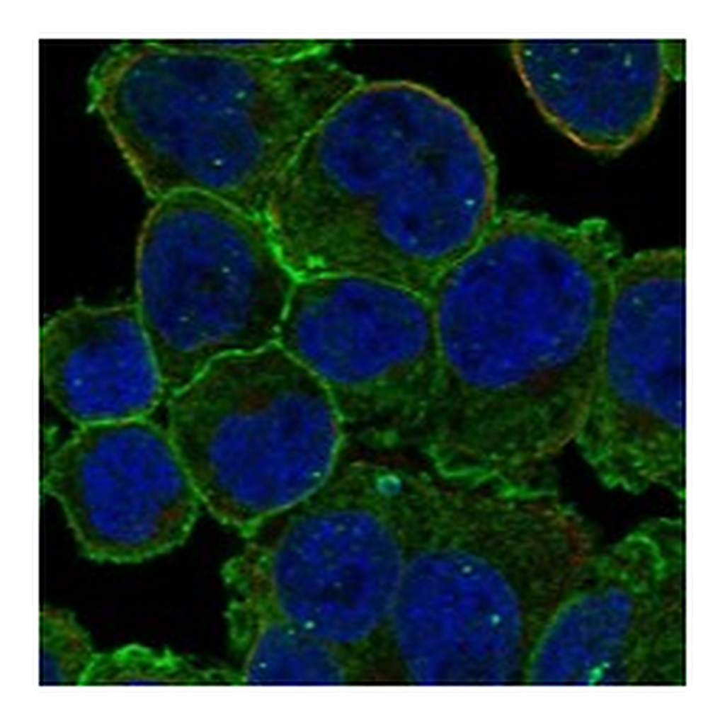 Atlas Antibodies Anti-EPB41 Antibody