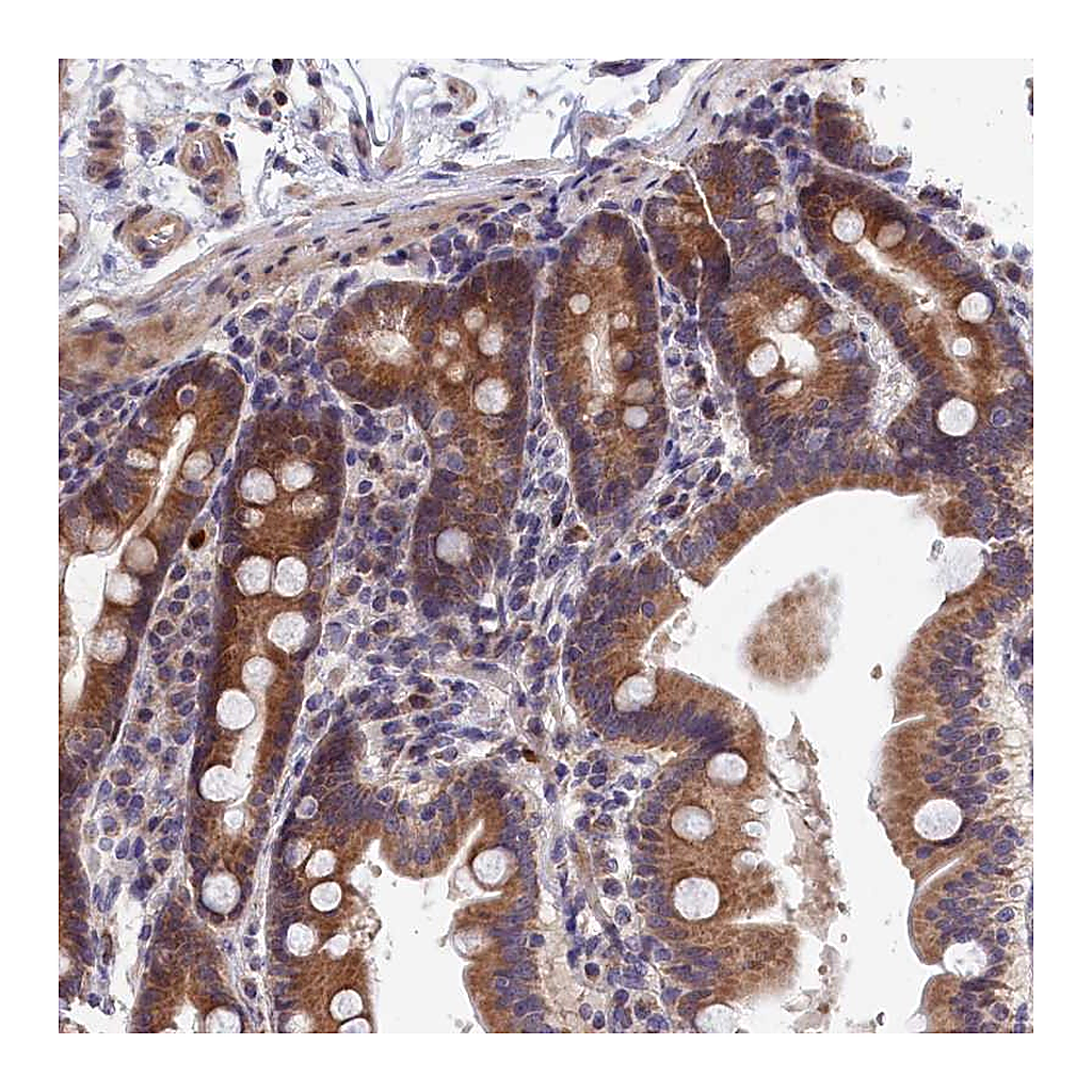 Atlas Antibodies Anti-EPB41L4B Antibody