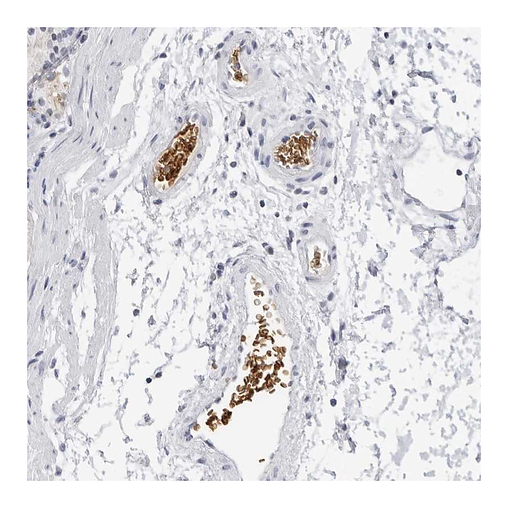 Atlas Antibodies Anti-EPB41 Antibody