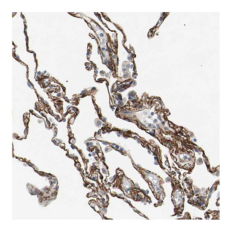 Atlas Antibodies Anti-EPB41L2 Antibody