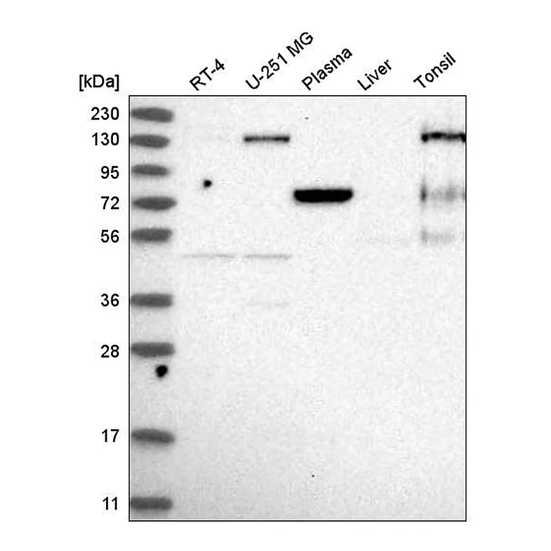 Atlas Antibodies Anti-EPB41 Antibody