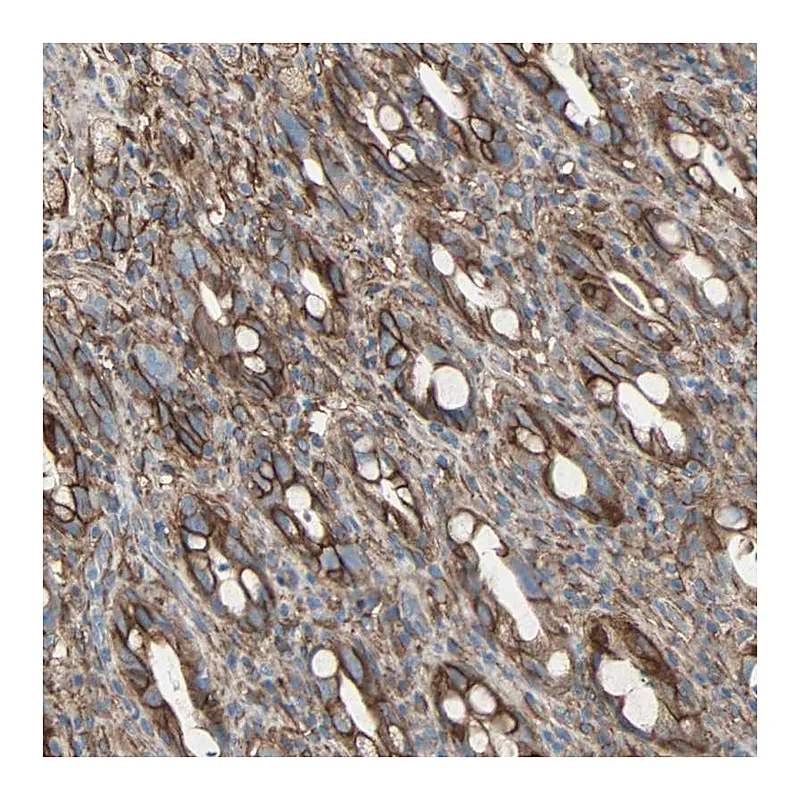 Atlas Antibodies Anti-EPB41L2 Antibody