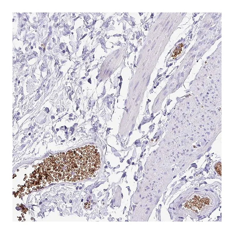 Atlas Antibodies Anti-EPB42 Antibody