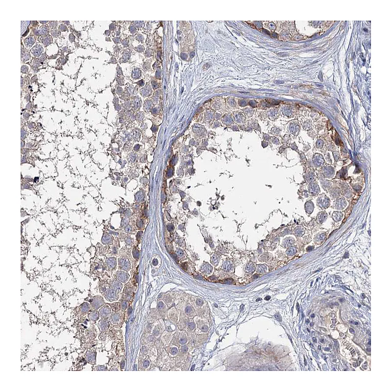 Atlas Antibodies Anti-EPB41L5 Antibody