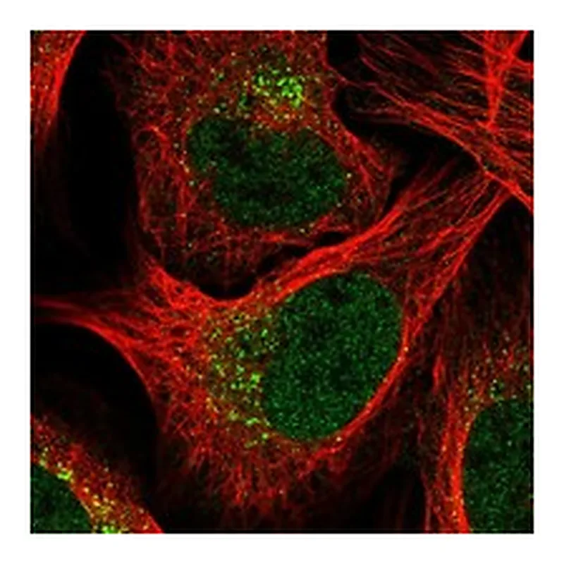 Atlas Antibodies Anti-EPC1 Antibody