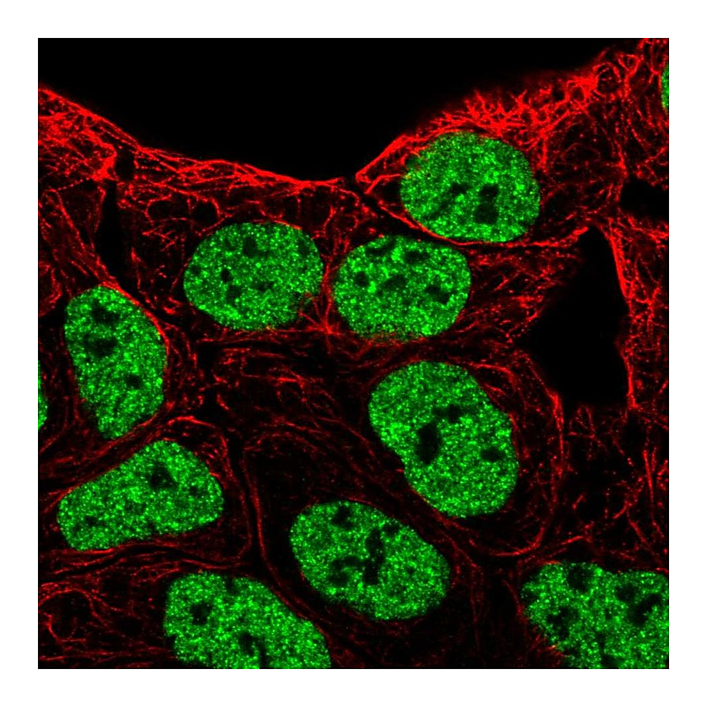 Atlas Antibodies Anti-EPHB6 Antibody