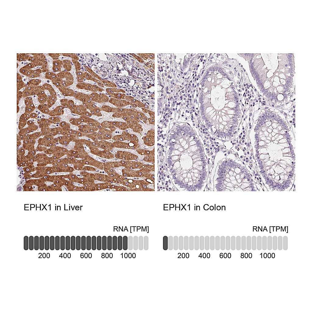 Atlas Antibodies Anti-EPHX1 Antibody