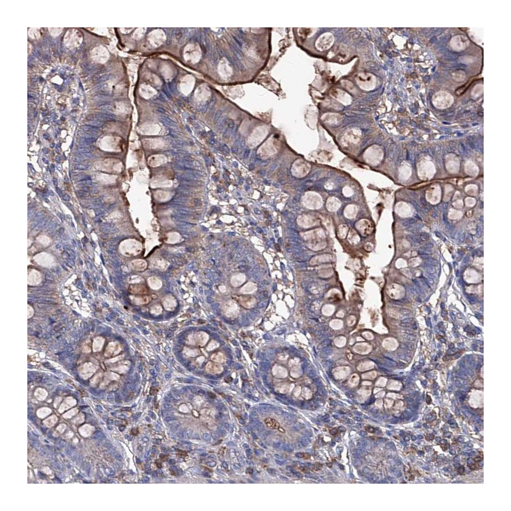 Atlas Antibodies Anti-EPHA8 Antibody
