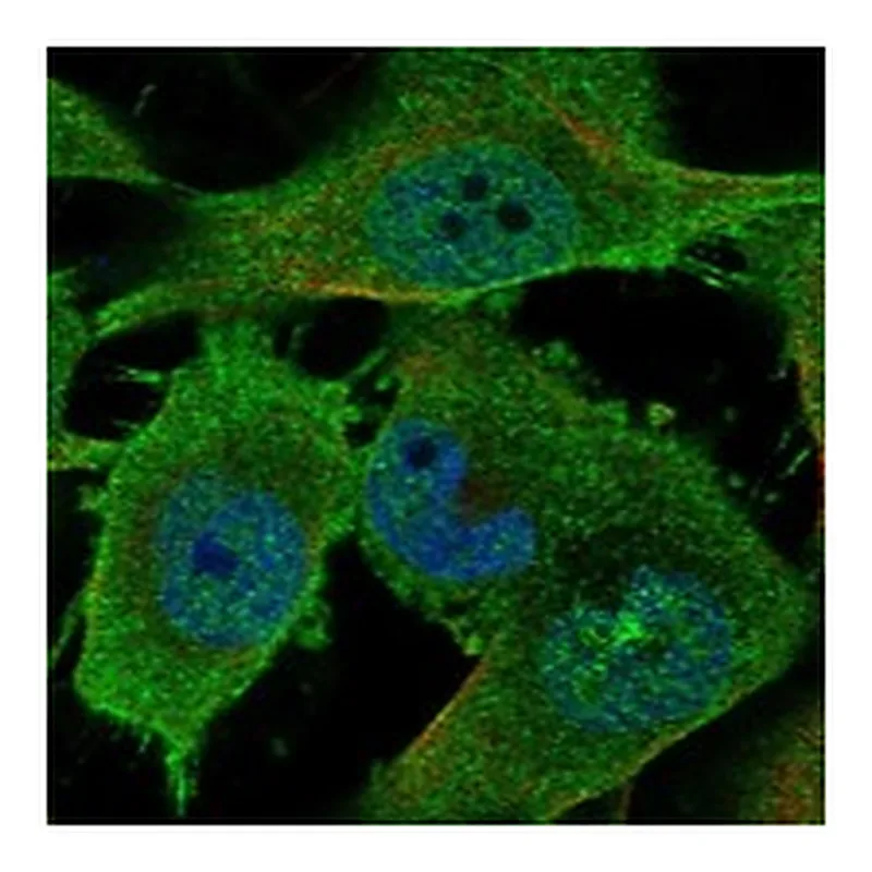 Atlas Antibodies Anti-EPHA3 Antibody