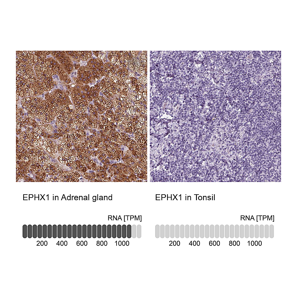 Atlas Antibodies Anti-EPHX1 Antibody