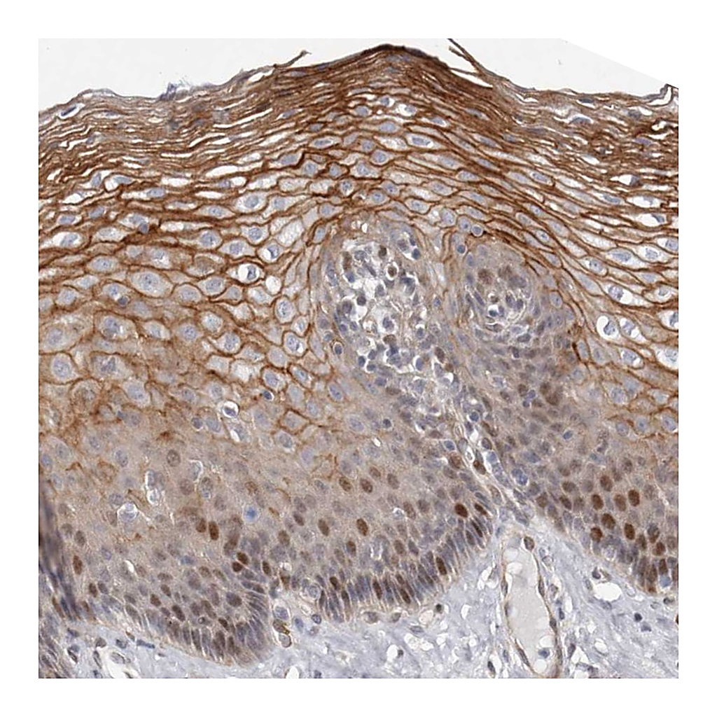 Atlas Antibodies Anti-EPHX3 Antibody