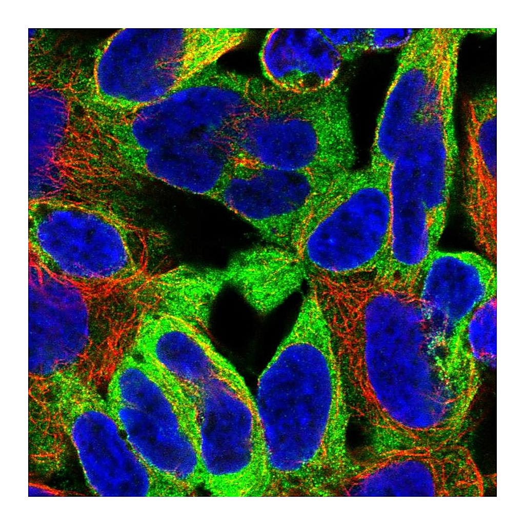 Atlas Antibodies Anti-EPN1 Antibody