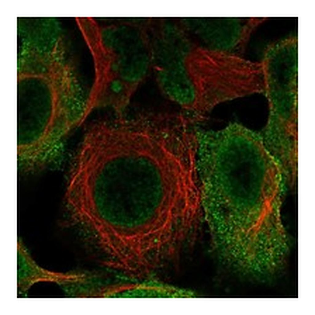 Atlas Antibodies Anti-EPN1 Antibody