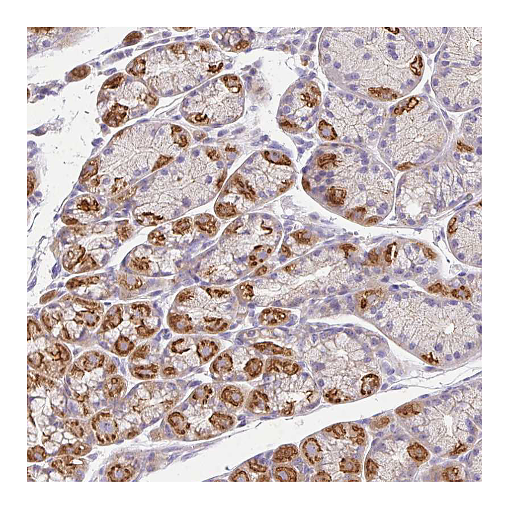 Atlas Antibodies Anti-EPN3 Antibody