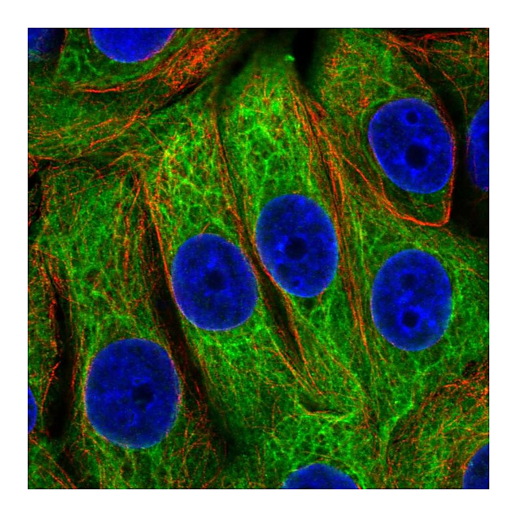 Atlas Antibodies Anti-EPPK1 Antibody