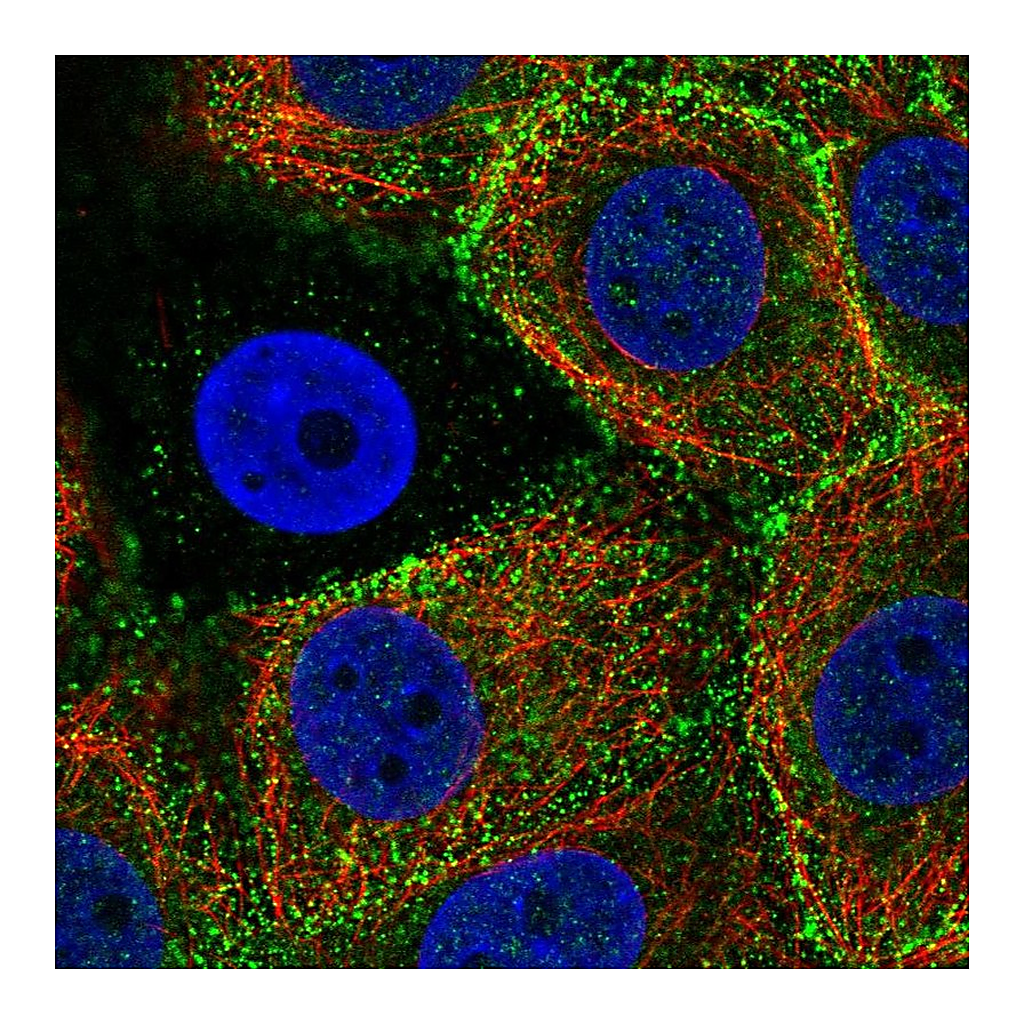 Atlas Antibodies Anti-EPN3 Antibody