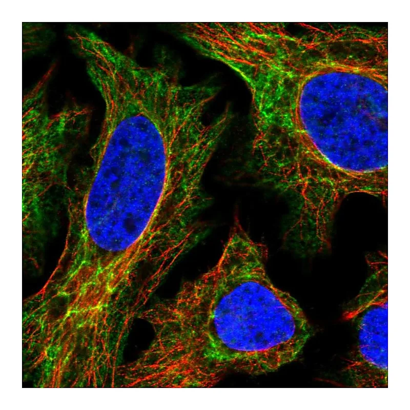 Atlas Antibodies Anti-EPPK1 Antibody