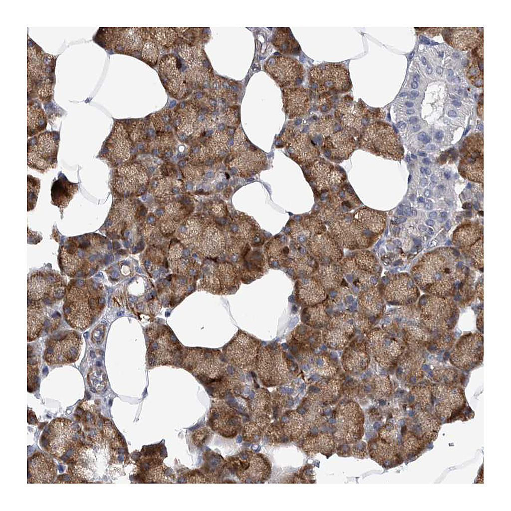 Atlas Antibodies Anti-EPRS Antibody