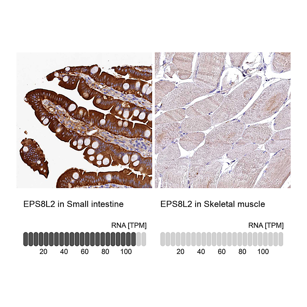 Atlas Antibodies Anti-EPS8L2 Antibody