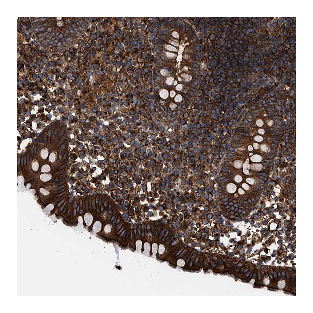 Atlas Antibodies Anti-EPS15L1 Antibody