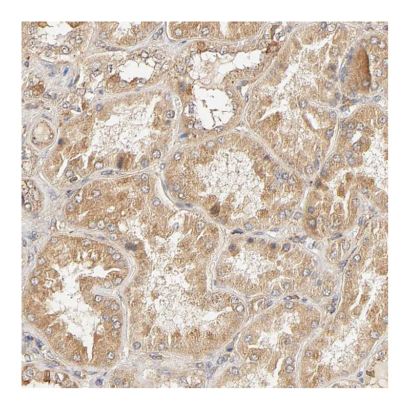 Atlas Antibodies Anti-EPS8 Antibody