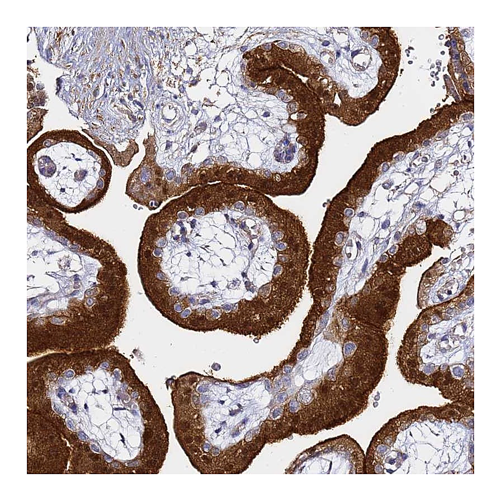 Atlas Antibodies Anti-EPS8L1 Antibody