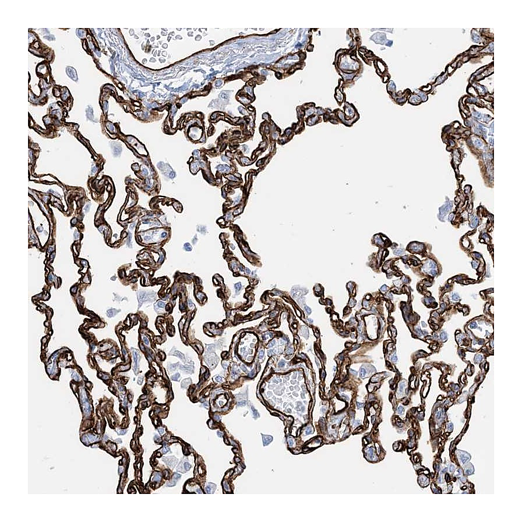 Atlas Antibodies Anti-EPS8L3 Antibody