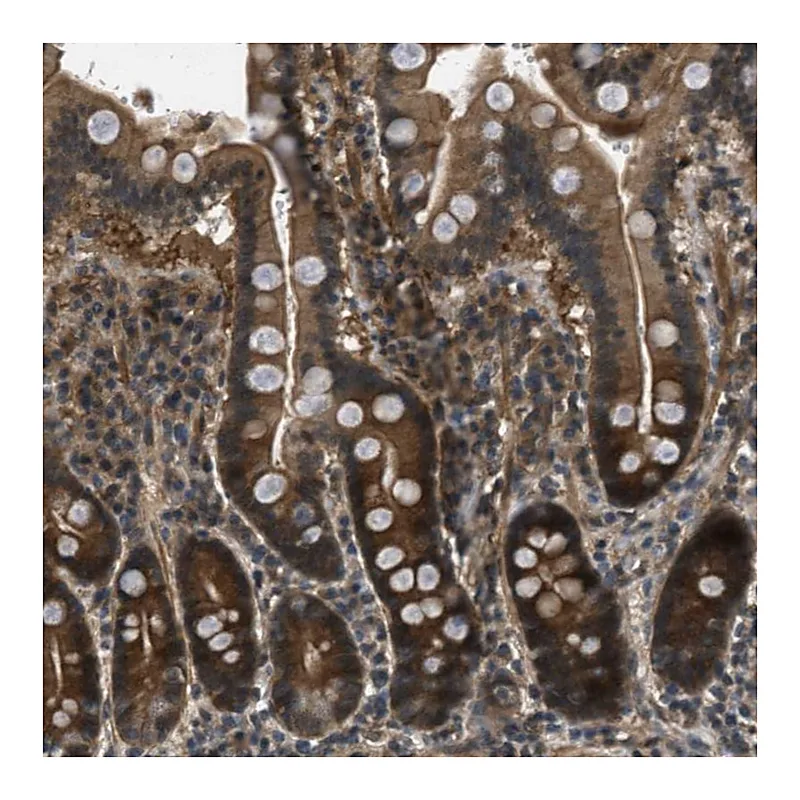 Atlas Antibodies Anti-EPSTI1 Antibody
