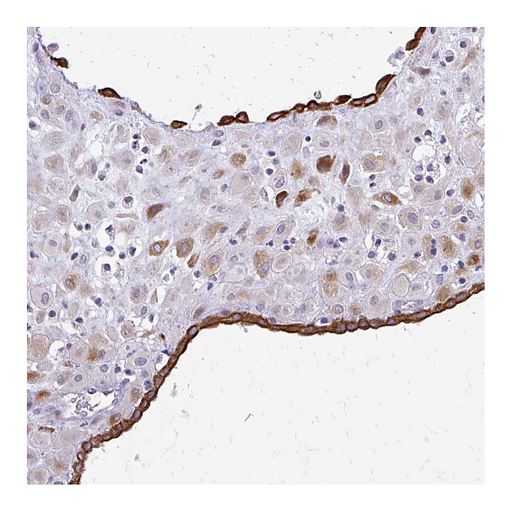 Atlas Antibodies Anti-EPYC Antibody