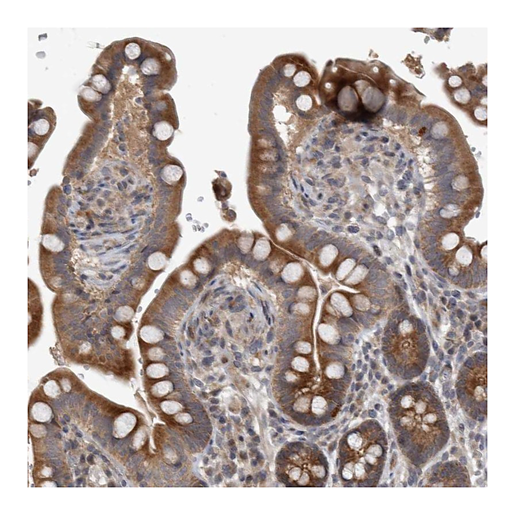 Atlas Antibodies Anti-ERAL1 Antibody