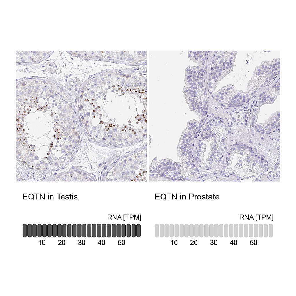 Atlas Antibodies Anti-EQTN Antibody