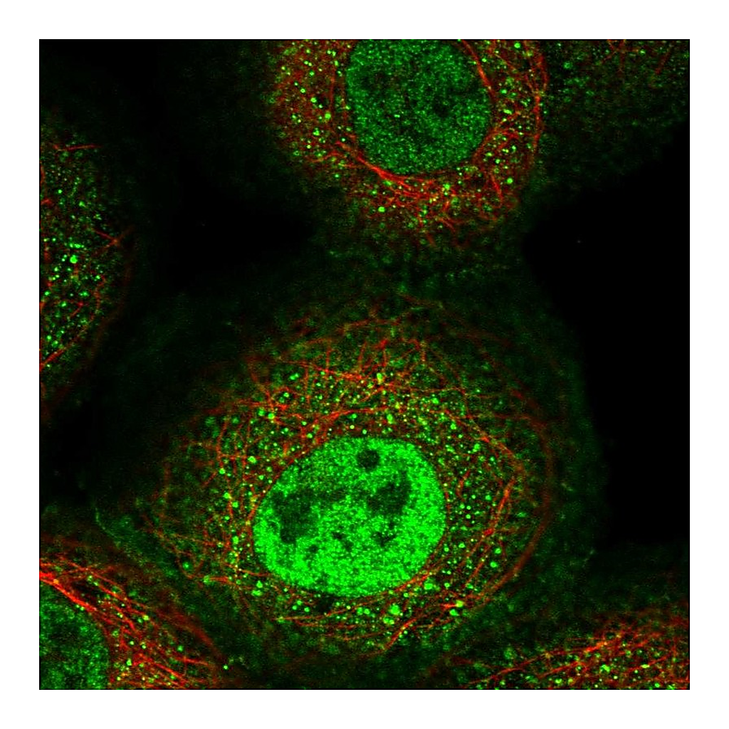 Atlas Antibodies Anti-ERAP1 Antibody