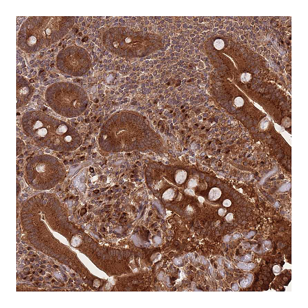 Atlas Antibodies Anti-ERBB3 Antibody