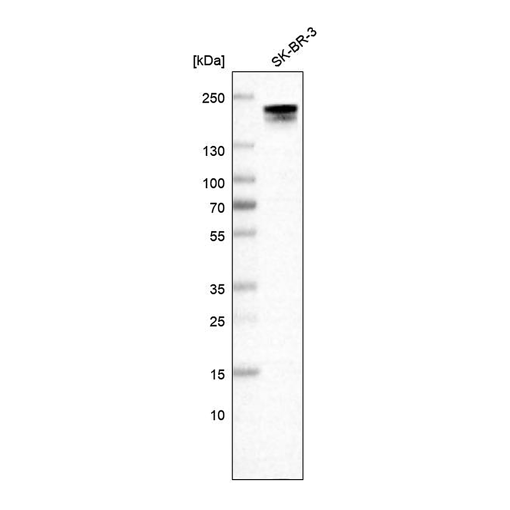 Atlas Antibodies Anti-ERBB2 Antibody